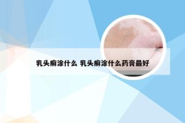 乳头癣涂什么 乳头癣涂什么药膏最好