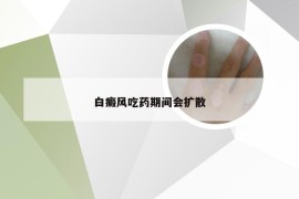 白癜风吃药期间会扩散