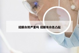 结膜白斑严重吗 结膜有白色凸起