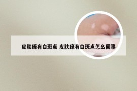 皮肤痒有白斑点 皮肤痒有白斑点怎么回事