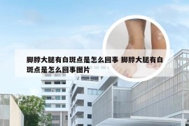 脚脖大腿有白斑点是怎么回事 脚脖大腿有白斑点是怎么回事图片