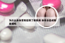 为什么身体受寒后得了银屑病 体寒会造成银屑病吗