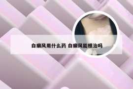 白癞风用什么药 白癞风能根治吗