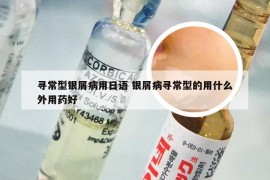 寻常型银屑病用日语 银屑病寻常型的用什么外用药好