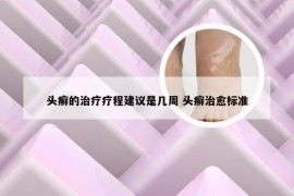 头癣的治疗疗程建议是几周 头癣治愈标准