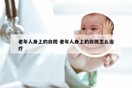 老年人身上的白斑 老年人身上的白斑怎么治疗