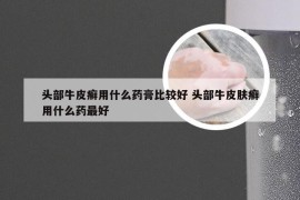 头部牛皮癣用什么药膏比较好 头部牛皮肤癣用什么药最好