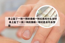 身上起了一块一块的像癣一样红色吃什么会好 身上起了一块一块的像癣一样红色会不会传染