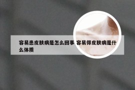 容易患皮肤病是怎么回事 容易得皮肤病是什么体质