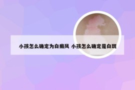 小孩怎么确定为白癜风 小孩怎么确定是白斑