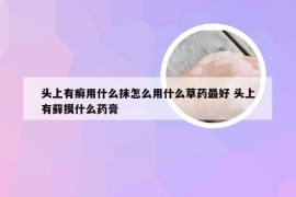 头上有癣用什么抹怎么用什么草药最好 头上有藓摸什么药膏