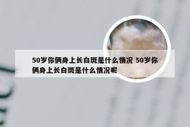 50岁你俩身上长白斑是什么情况 50岁你俩身上长白斑是什么情况呢