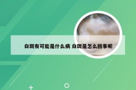 白斑有可能是什么病 白斑是怎么回事呢