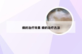 癫的治疗效果 癫的治疗方法