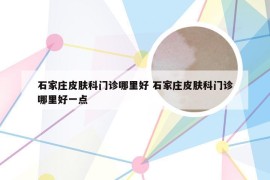 石家庄皮肤科门诊哪里好 石家庄皮肤科门诊哪里好一点