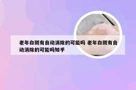 老年白斑有自动消除的可能吗 老年白斑有自动消除的可能吗知乎