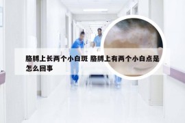 胳膊上长两个小白斑 胳膊上有两个小白点是怎么回事