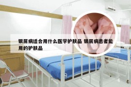 银屑病适合用什么医学护肤品 银屑病患者能用的护肤品