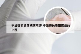 宁波哪家银屑病医院好 宁波擅长看银屑病的中医