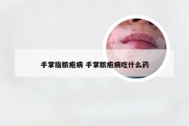 手掌指脓疱病 手掌脓疱病吃什么药