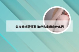 头皮癣啥药管事 治疗头皮癣吃什么药