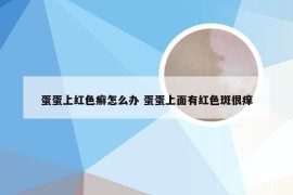 蛋蛋上红色癣怎么办 蛋蛋上面有红色斑很痒