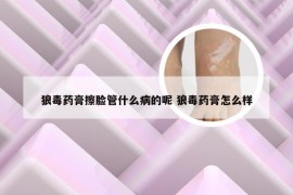 狼毒药膏擦脸管什么病的呢 狼毒药膏怎么样