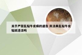 关于严禁乱贴牛皮癣的通告 民法典乱贴牛皮贴纸违法吗