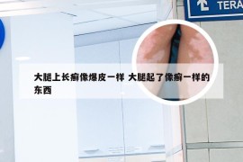 大腿上长癣像爆皮一样 大腿起了像癣一样的东西