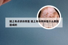 腿上有点状白斑是 腿上有白斑块是什么原因造成的