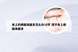 身上的癣越来越多怎么办15岁 孩子身上癣越来越多