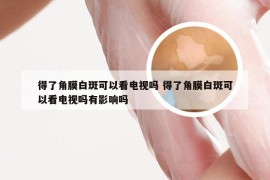 得了角膜白斑可以看电视吗 得了角膜白斑可以看电视吗有影响吗