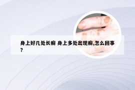 身上好几处长癣 身上多处出现癣,怎么回事?