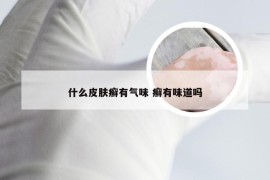 什么皮肤癣有气味 癣有味道吗