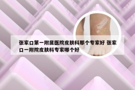 张家口第一附属医院皮肤科那个专家好 张家口一附院皮肤科专家哪个好