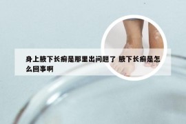 身上腋下长癣是那里出问题了 腋下长癣是怎么回事啊