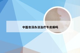 中医也没办法治疗牛皮癣吗