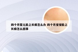 四个月婴儿脸上长癣怎么办 四个月宝宝脸上长癣怎么回事