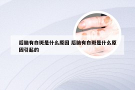 后脑有白斑是什么原因 后脑有白斑是什么原因引起的