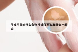 牛皮不能吃什么食物 牛皮不可以和什么一起吃