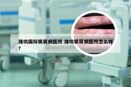 潍坊国际银屑病医院 潍坊银屑病医院怎么样?