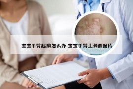 宝宝手臂起癣怎么办 宝宝手臂上长藓图片