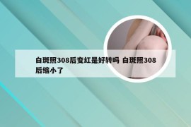 白斑照308后变红是好转吗 白斑照308后缩小了