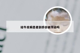 给牛皮癣患者刮痧会被传染吗