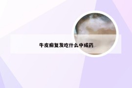 牛皮癣复发吃什么中成药