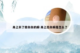 身上长了些白白的癣 身上出白癣是怎么了