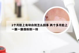 2个月脸上有块白斑怎么回事 两个多月脸上一颗一颗像粉刺一样