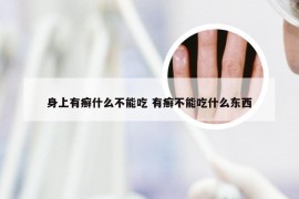 身上有癣什么不能吃 有癣不能吃什么东西