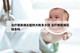 治疗银屑病去医院大概多少钱 治疗银屑病花钱多吗