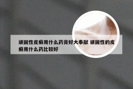 顽固性皮癣用什么药膏好大奉献 顽固性的皮癣用什么药比较好